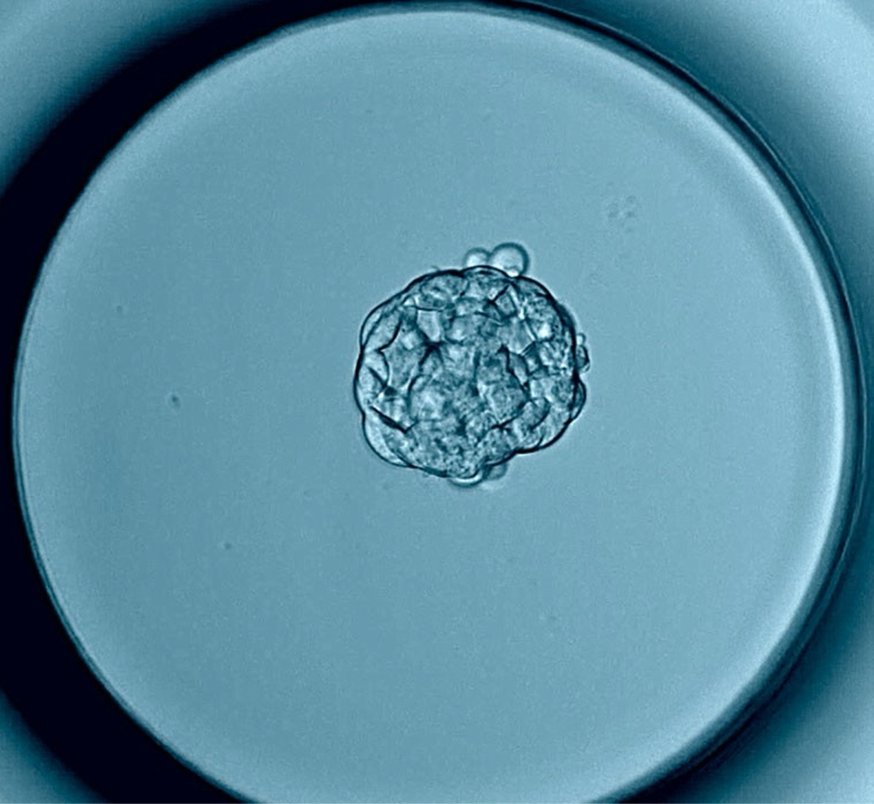 Blastokist Kültürü